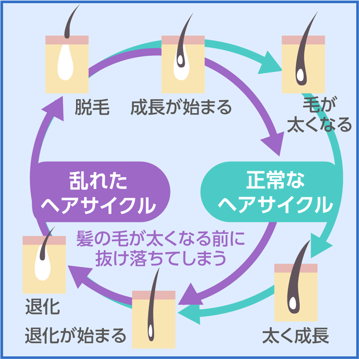 育毛剤おすすめ11選【2023年11月版】薄毛改善効果が目指せる育毛剤を